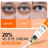 Eye Cream Anti Dark Circles Eye Bag